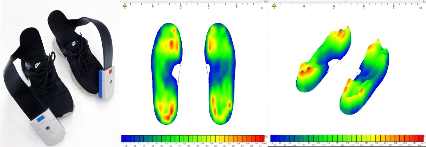 Painepohjalliset ja niistä tulostuva kuva jalkapohjista